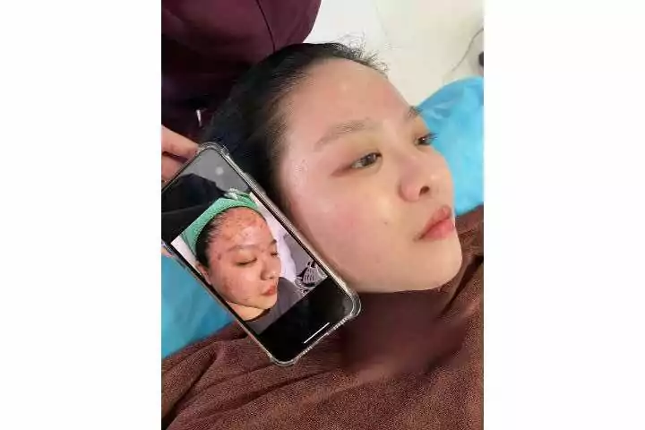Kan Spa Beauty TP. Bến Tre