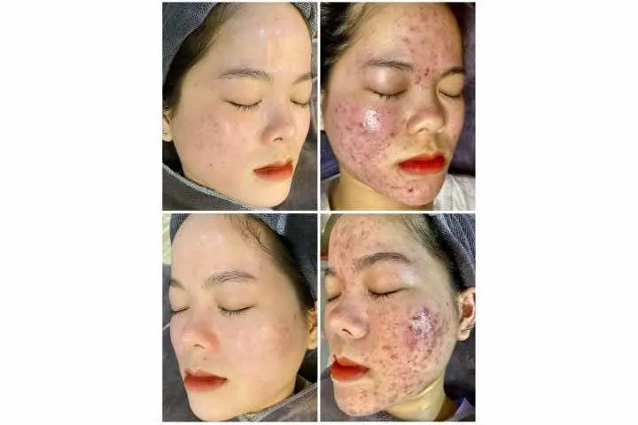 Nhã Phương Spa TP. Bến Tre