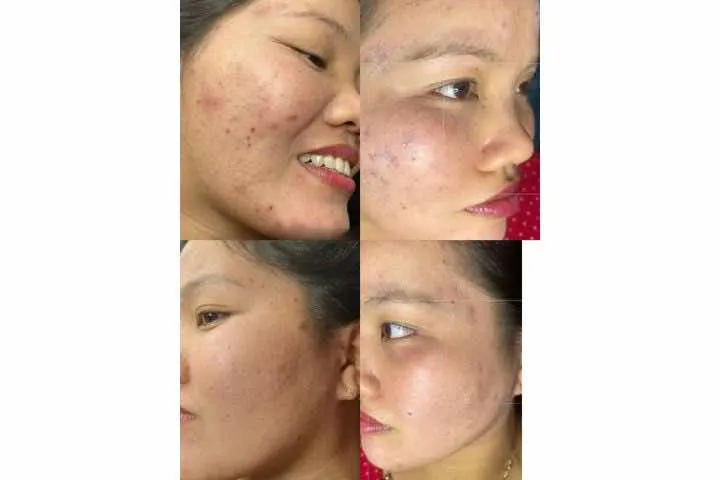 Spa Nguyễn Thanh Bến Tre