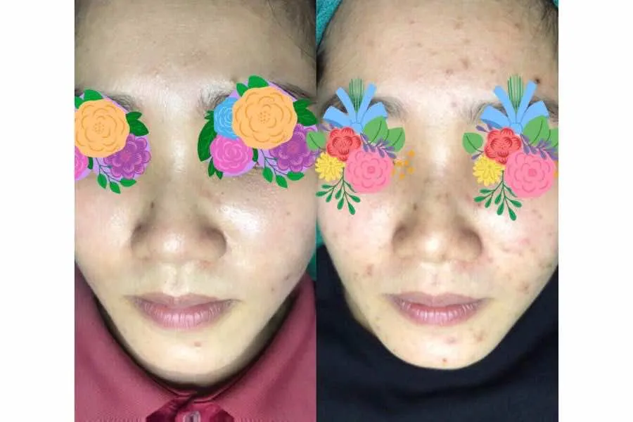 Gomi Spa Bình Dương