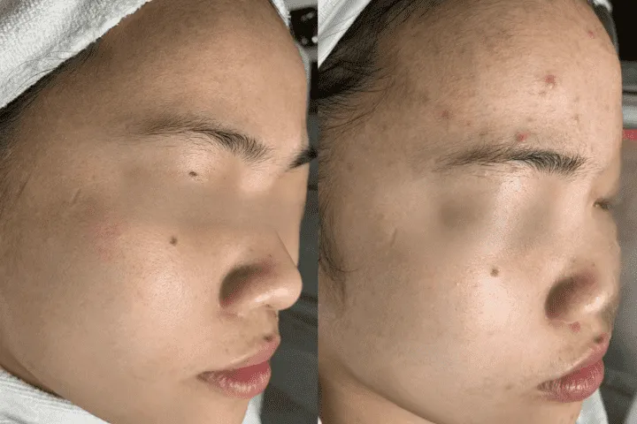 Thẩm Mỹ Viện Hằng Hàn Thái Bình