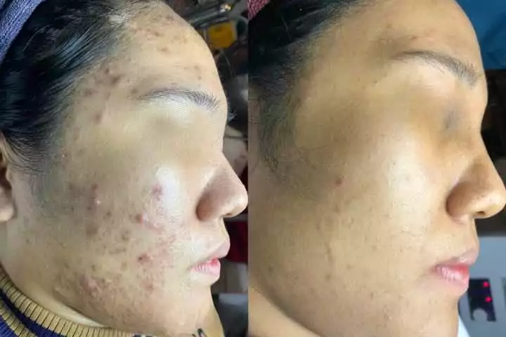 Thăng Long Beauty Clinic Ninh Bình