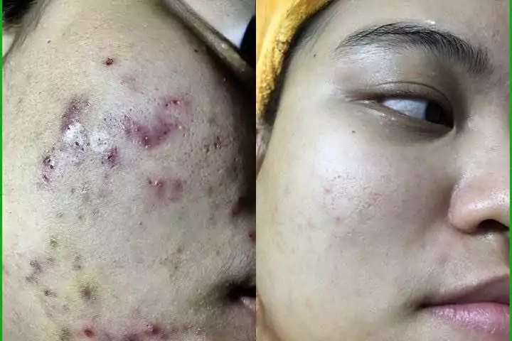 Thanh Hải Spa Ninh Bình