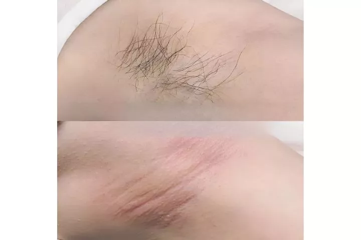 Fancy Spa Quận 4