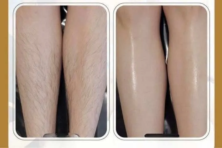 Hằng Nga Spa Bình Phước