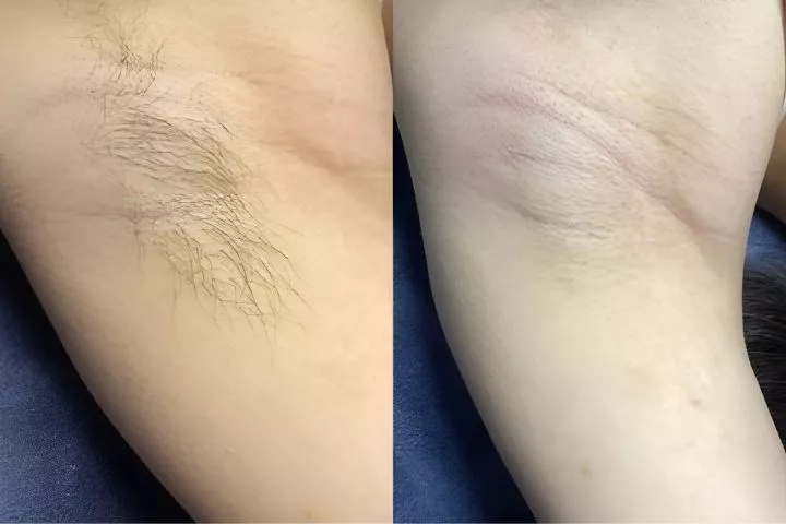 Hanu Spa Quy Nhơn