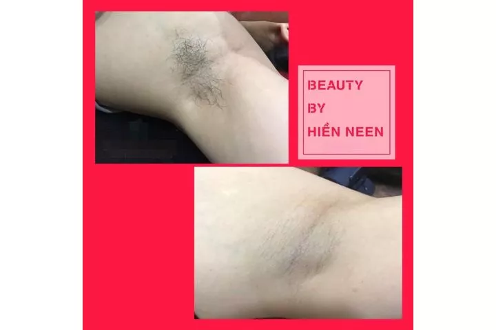 Hiền Neen Spa Lâm Đồng