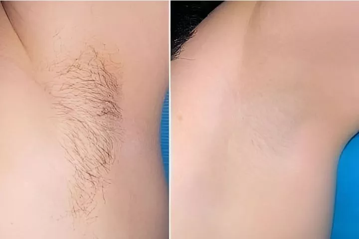 Linh’s Beauty Spa Nghệ An