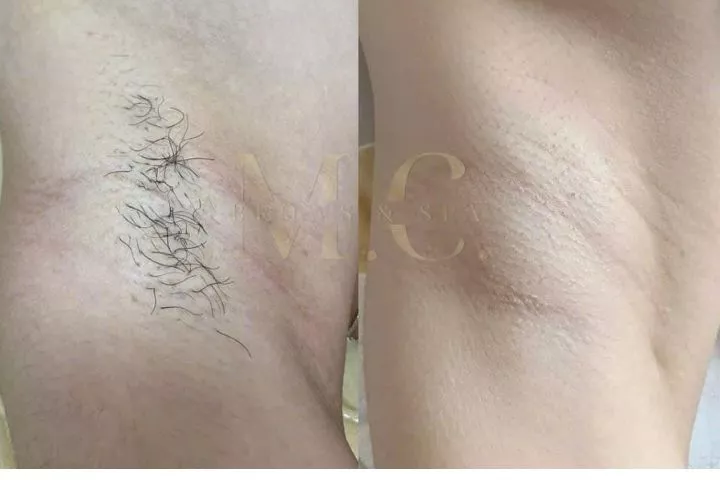 M.C Brows & Spa Hải Dương