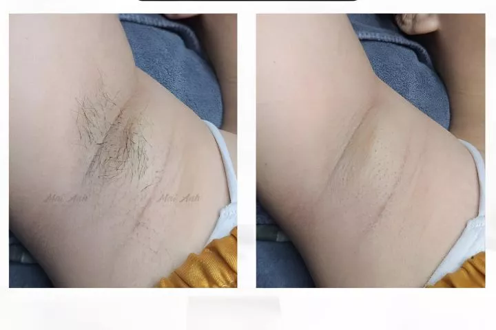 Mai Anh Spa Quận 11