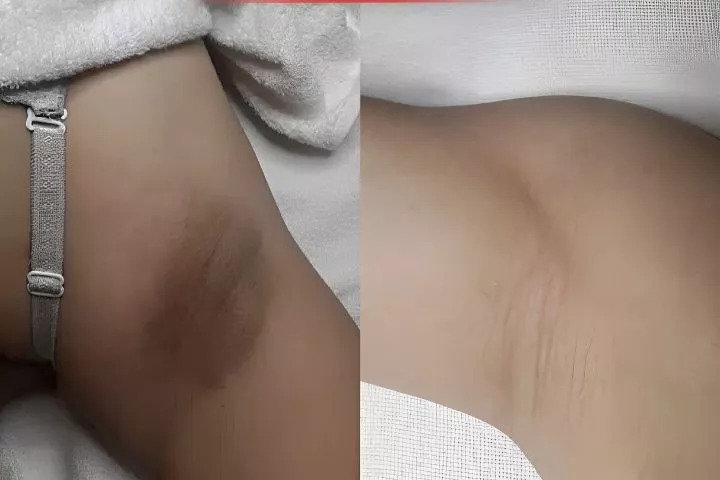 Mimosa Spa Cần Giờ