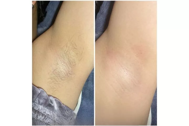 Nhi Tây Spa Bình Thuận
