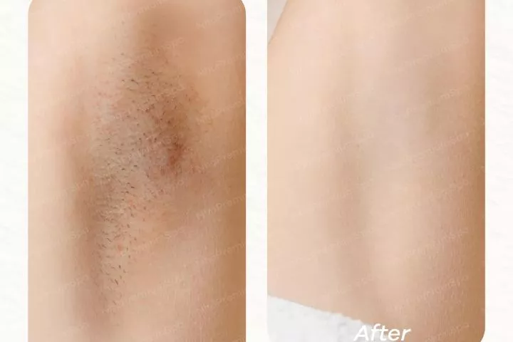 Nhỏ Premium Spa Quận 9