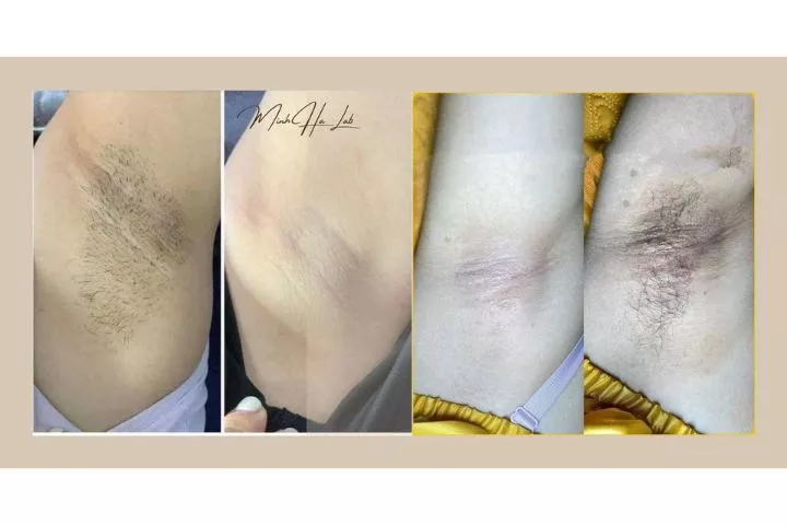 Spa Muối Hồng Hải Phòng