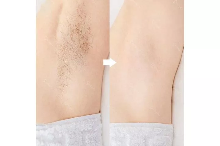 Spa Thu Hiếu Nhà Bè