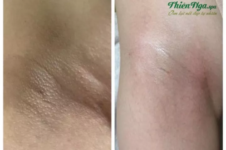 Thẩm Mỹ Viện Thiên Nga Long An