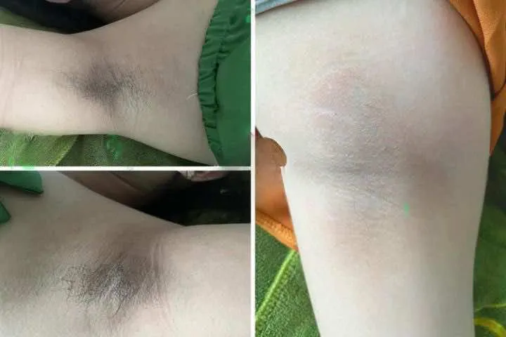 Tuyết Nhi Spa Bình Phước