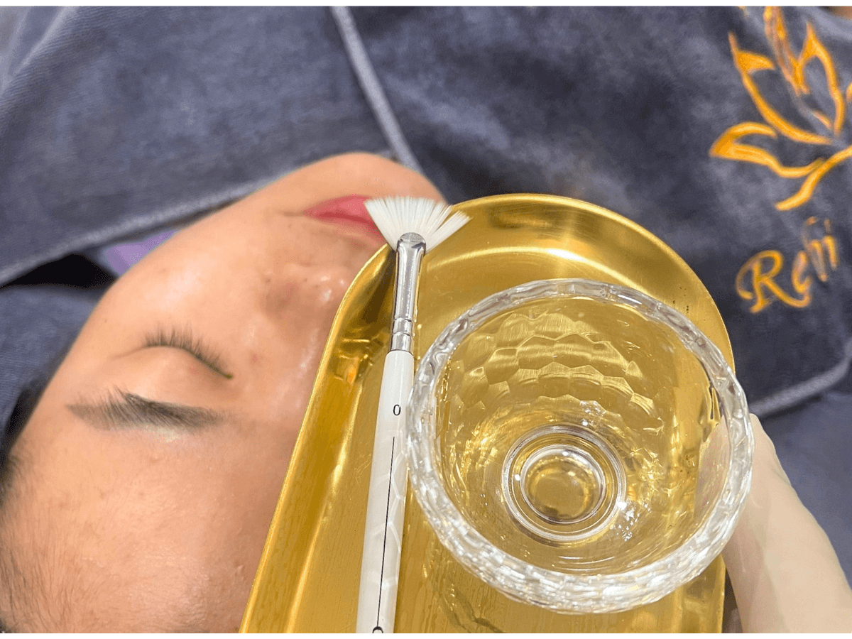 Dịch vụ Chemical Peel