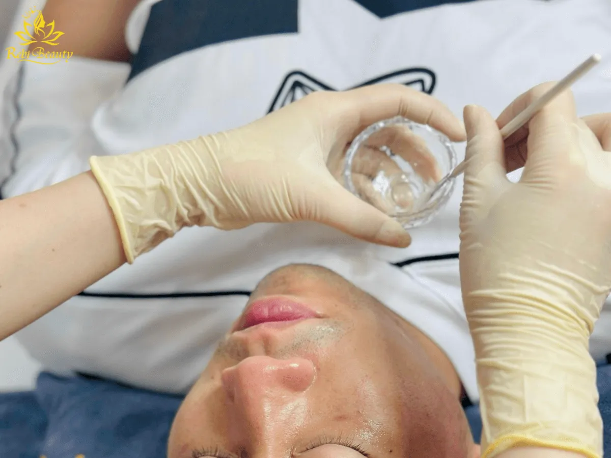 Chemical Peel là một phương pháp làm đẹp phổ biến hiện nay tại các spa, thẩm mỹ viện