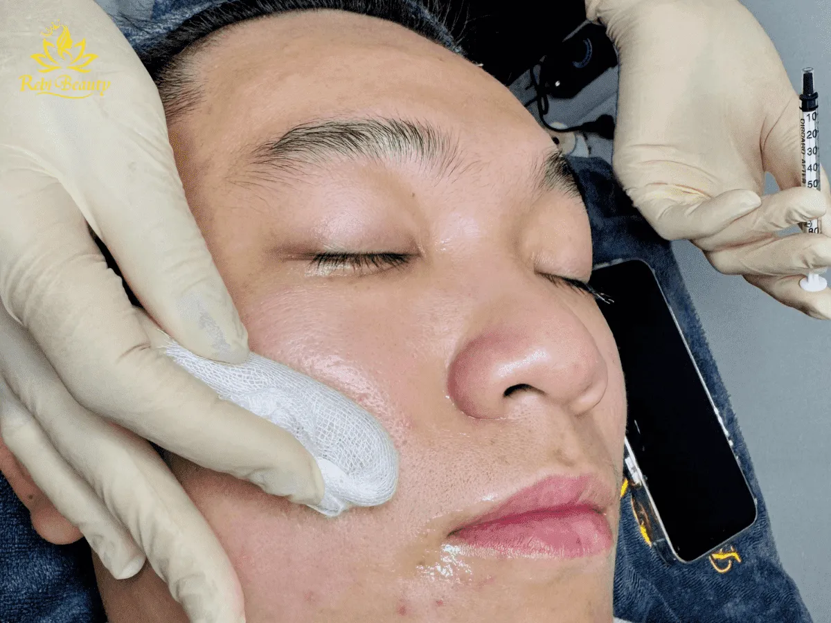 Chemical Peel sử dụng các hợp chất tự nhiên để kích thích thay da mới