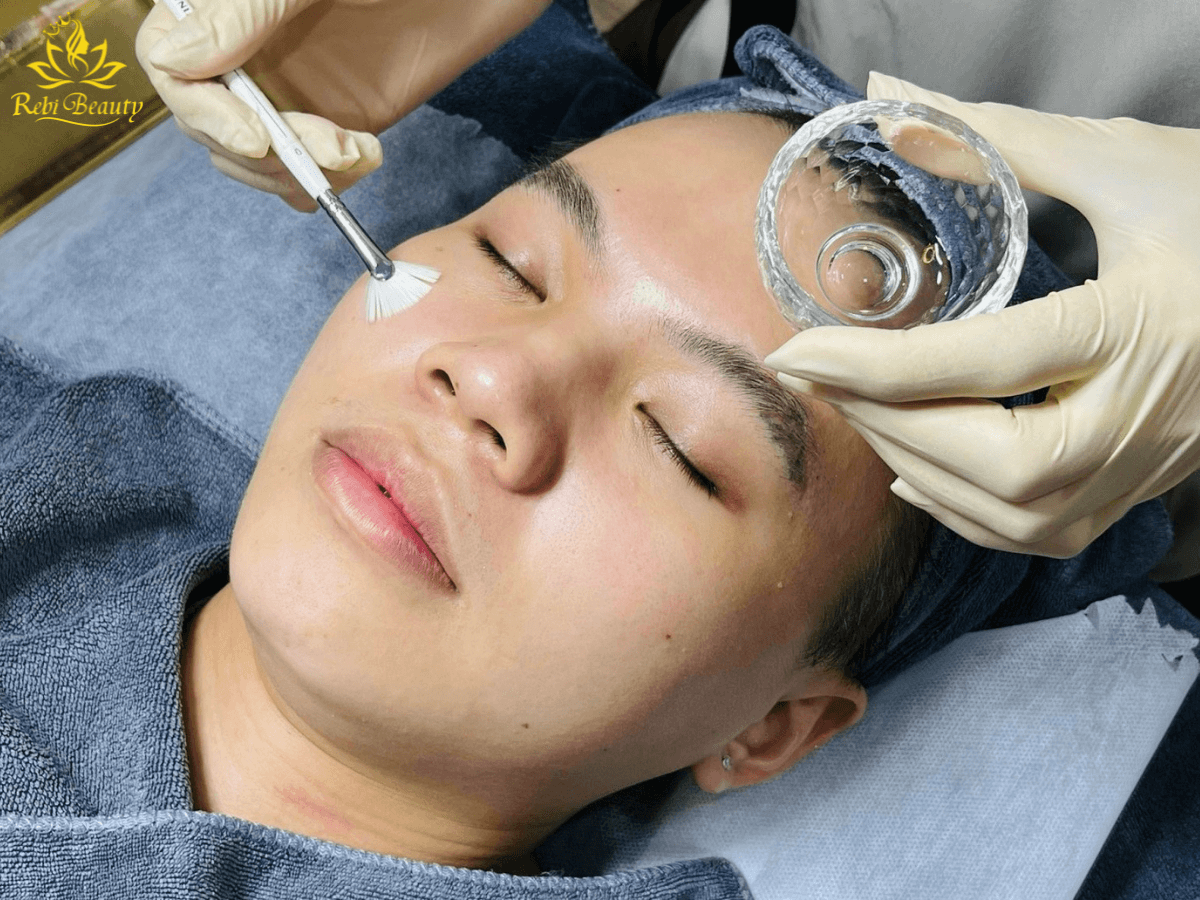 Liệu pháp peel da hóa học hay còn gọi là chemical peel