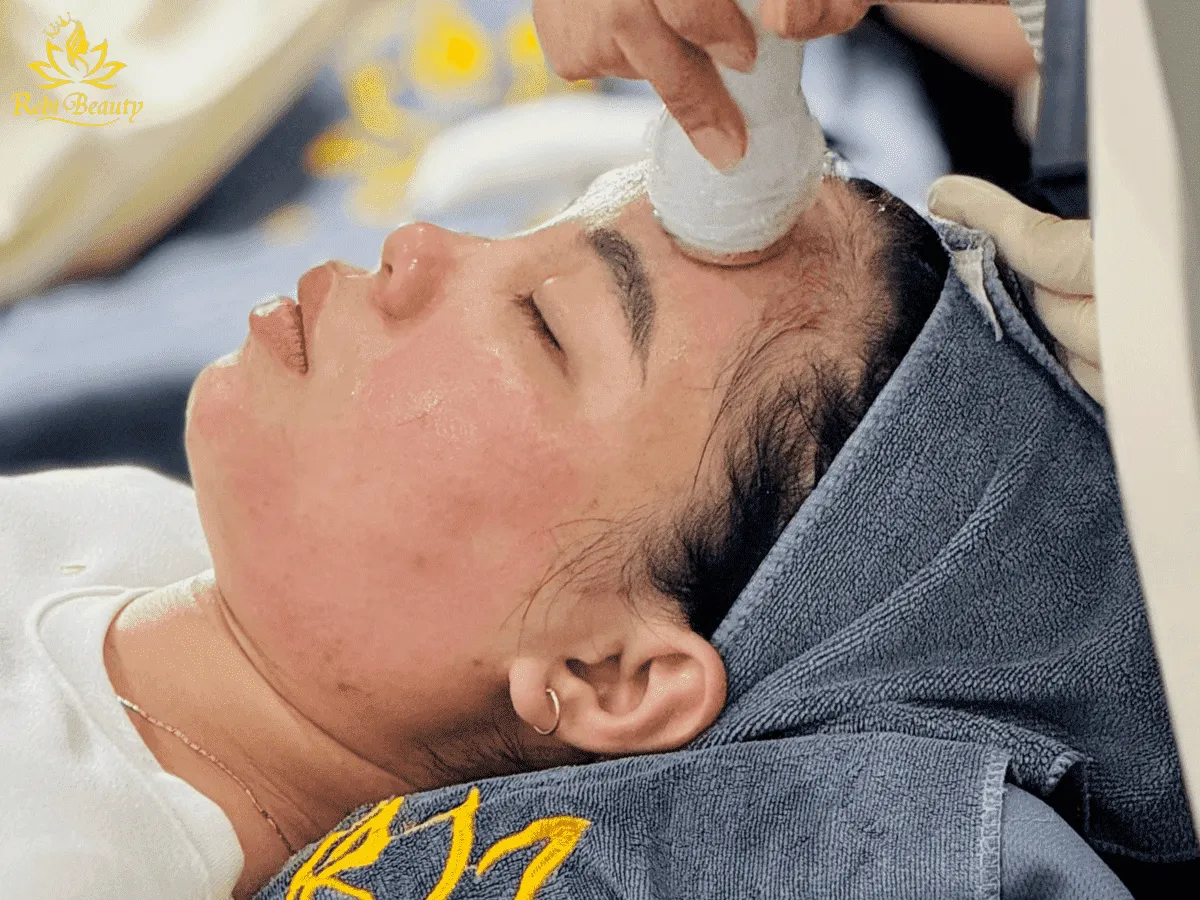 Luôn chuẩn bị giải pháp xử lý biến chứng trước và sau khi peel