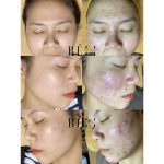 BELI Beauty Spa tai Quan Phu Nhuan