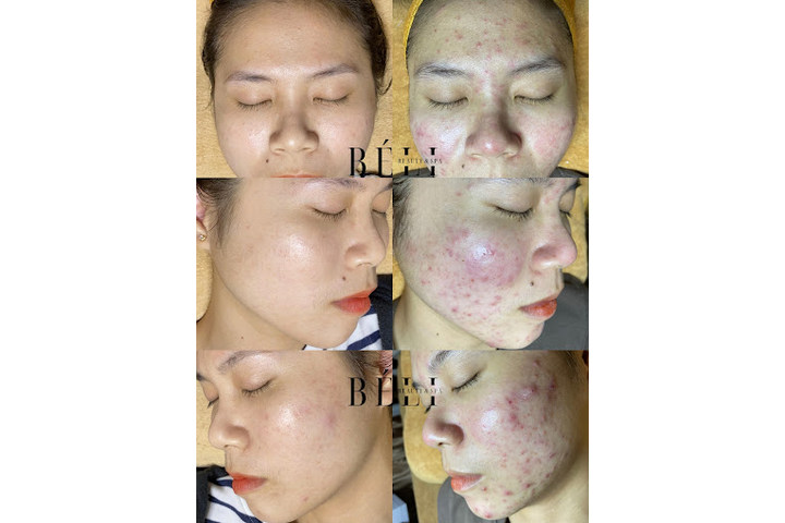 BELI Beauty Spa tai Quan Phu Nhuan