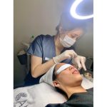 Khách đang điều trị mụn tại CAM Beauty Clinic Quận Tân Phú