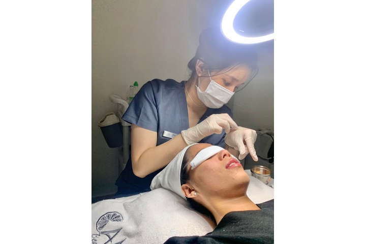 Khách đang điều trị mụn tại CAM Beauty Clinic Quận Tân Phú