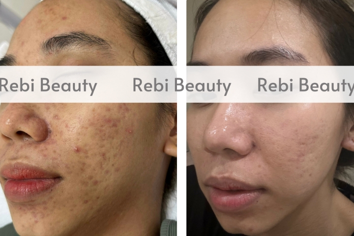 Rebi Beauty Quận Tân Bình (2)