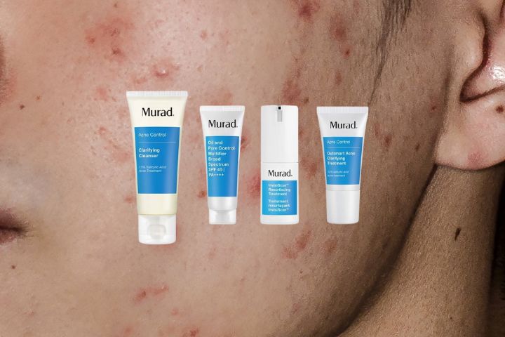 Bộ sản phẩm trị mụn Murad