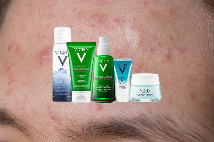 Bộ sản phẩm trị mụn Vichy