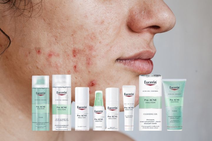 Bộ sản phẩm trị mụn Eucerin