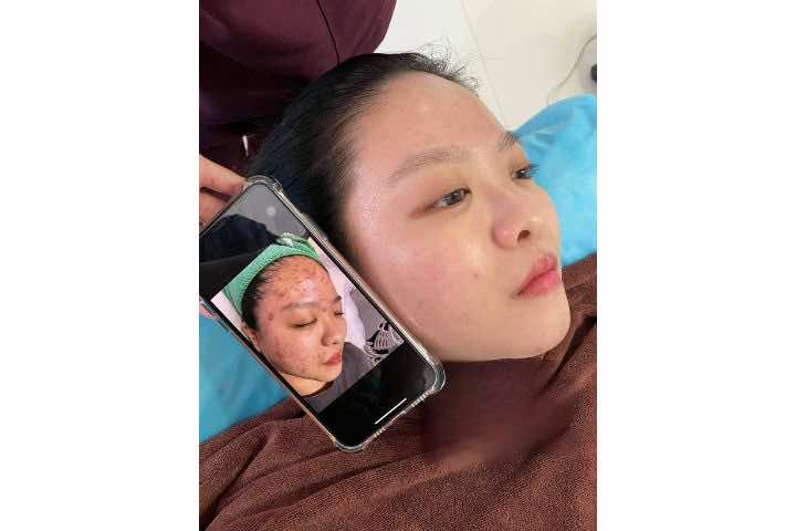 Kan Spa Beauty TP. Bến Tre