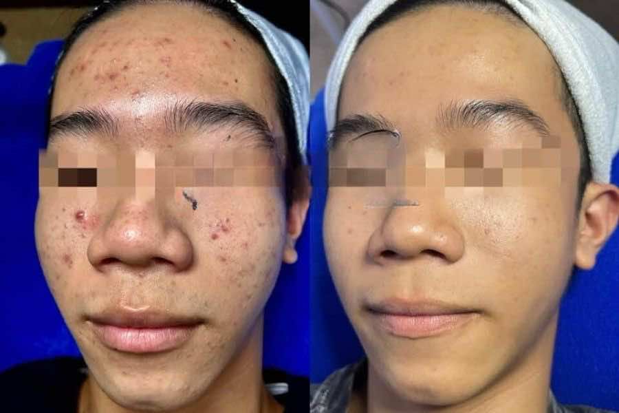 Nữ Hoàng Sắc Đẹp Spa Cà Mau