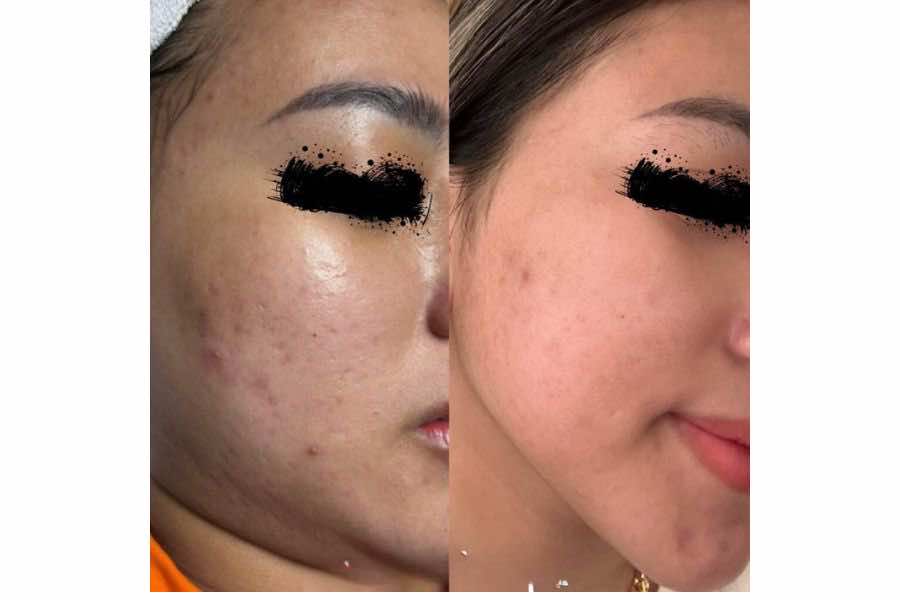 Spa Hoa Hồng Cà Mau