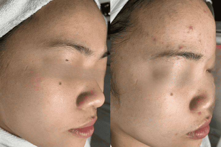 Thẩm Mỹ Viện Hằng Hàn Thái Bình