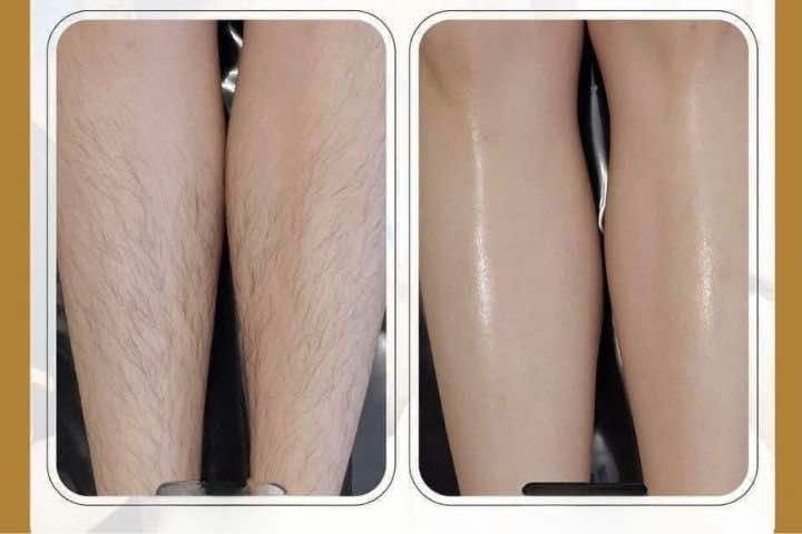 Hằng Nga Spa Bình Phước