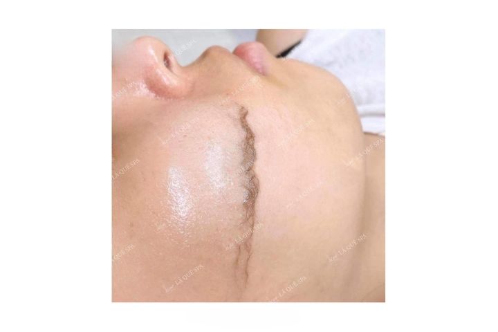 Lá Quê Spa Bình Thuận