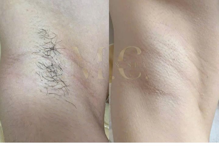 M.C Brows & Spa Hải Dương