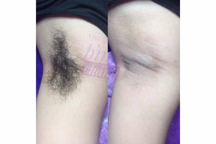 Queen Spa Huyện Bình Chánh