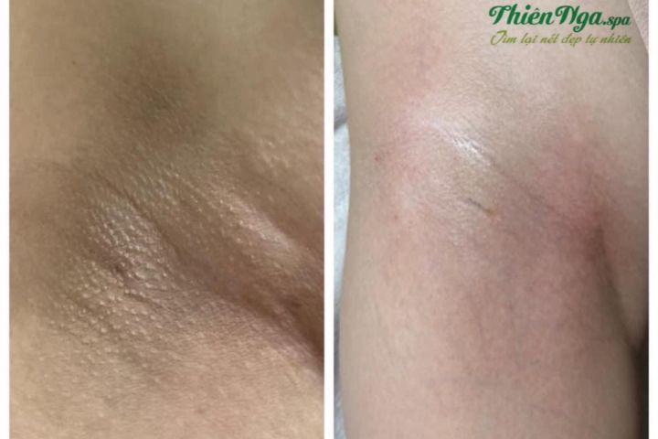 Thẩm Mỹ Viện Thiên Nga Long An Thẩm Mỹ Viện Thiên Nga Long An