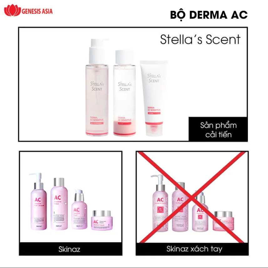 Hình ảnh so sánh trước và sau khi sử dụng bộ sản phẩm trị mụn Skinaz cho làn da cải thiện rõ rệt