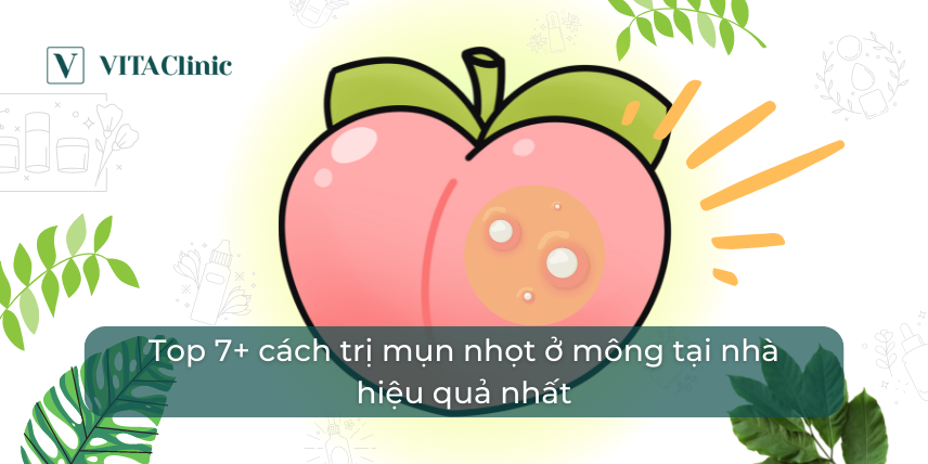 Cách trị thâm mụn nhọt ở mông dứt điểm, hiệu quả nhất Cach Tri Tham Mun Nhot O Mong Dut Diem Hieu Qua Nhat Image 2