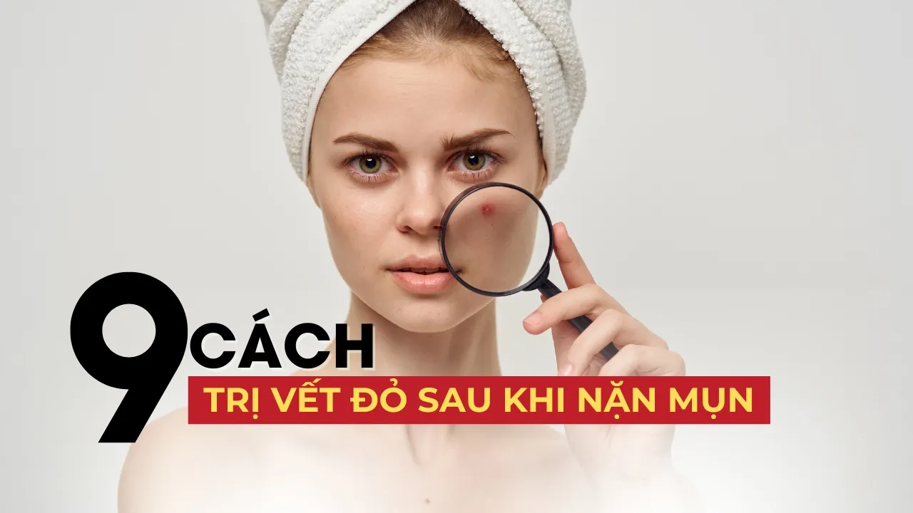 Cach Tri Seo Do Sau Mun Hieu Qua Va An Toan Nhat Image 1
