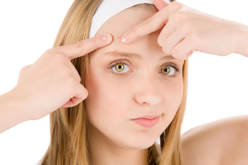 Bỏ tiền mua mỹ phẩm xịn nhưng mụn vẫn hoành hành, nguyên nhân vì đâu?