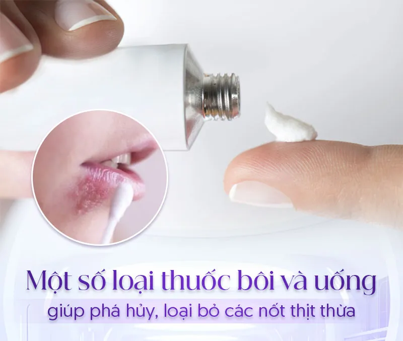 Sử dụng thuốc là một cách trị mụn thịt ở môi được bác sĩ khuyên dùng