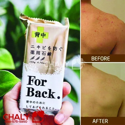 xa phong tri mun lung for back mediated soap pelican 15